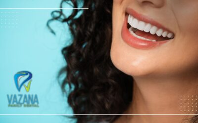 veneers