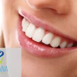 teeth whitening